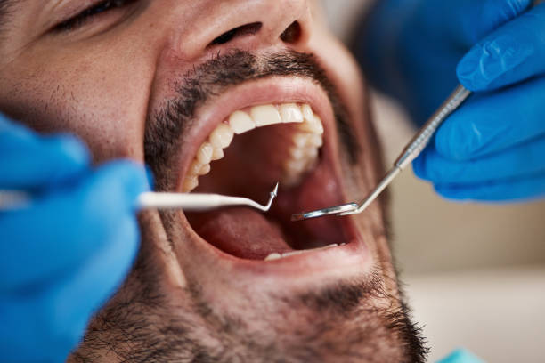 Best Emergency Dental Services for Seniors in Moosup, CT