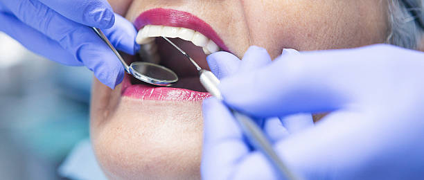 Best Emergency Dentist for Lost Fillings or Crowns in Moosup, CT